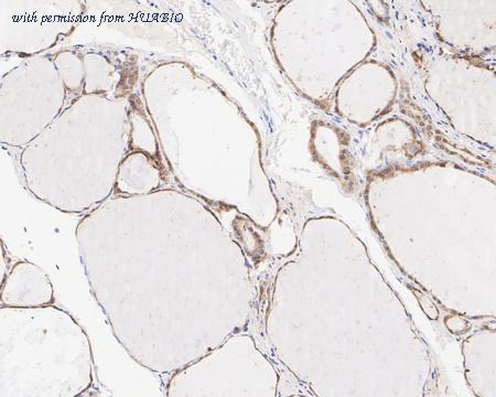 HUABIO HA722241 image 3