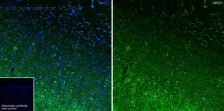 HUABIO HA722244 image 2