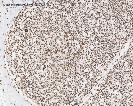 HUABIO HA722266 image 3