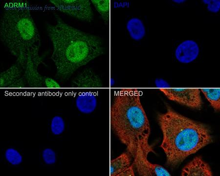 HUABIO HA722270 image 2