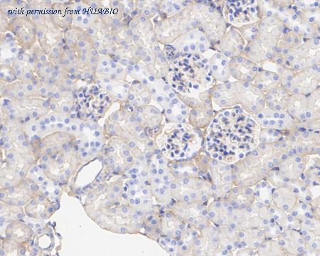 HUABIO HA722277 image 3