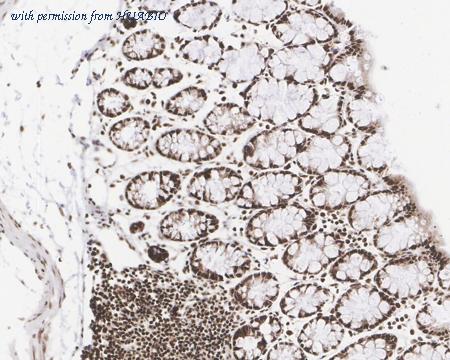 HUABIO HA722283 image 3