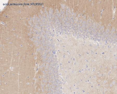 HUABIO HA722284 image 3