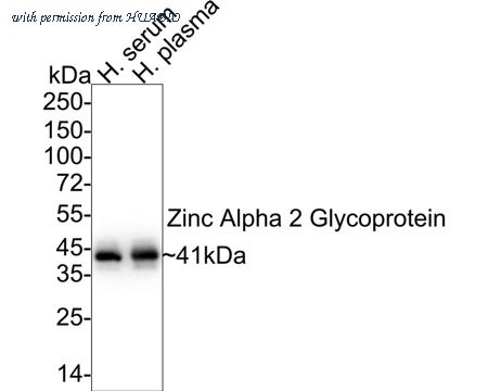 HUABIO HA722298 image 1