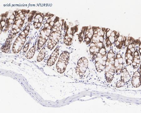 HUABIO HA722317 image 2