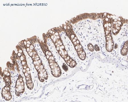 HUABIO HA722317 image 3