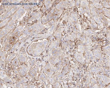 HUABIO HA722327 image 3