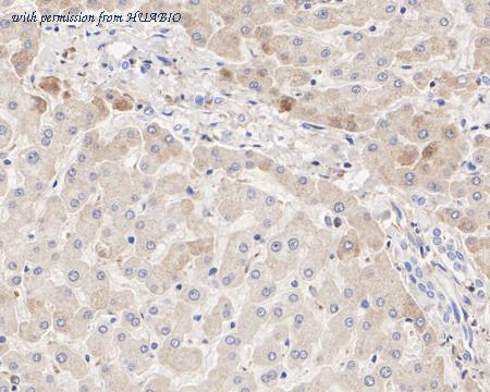 HUABIO HA722336 image 2