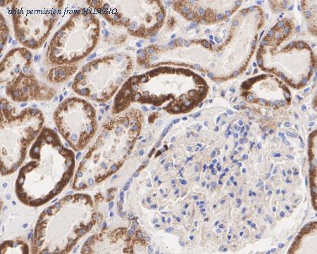 HUABIO HA722336 image 3