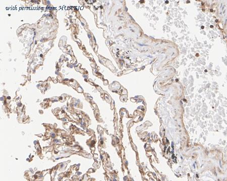 HUABIO HA722340 image 3