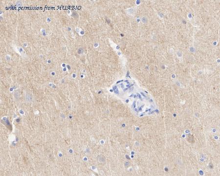 HUABIO HA722362 image 3