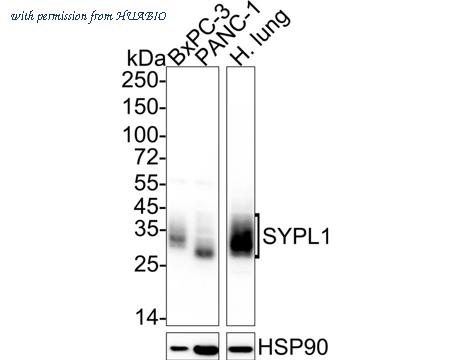 HUABIO HA722387 image 1