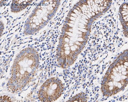 HUABIO HA722407 image 2