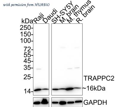 HUABIO HA722414 image 1