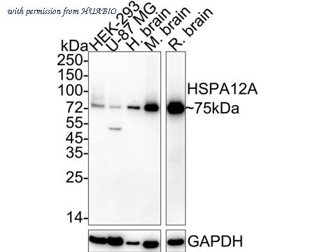 HUABIO HA722425 image 1