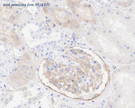 HUABIO HA722425 image 2