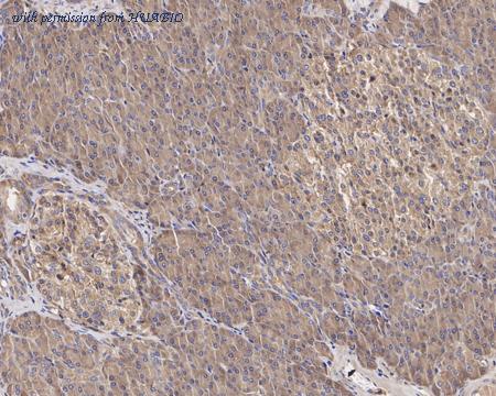 HUABIO HA722430 image 2