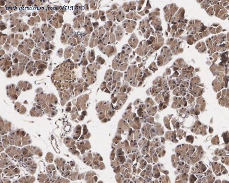 HUABIO HA722430 image 3