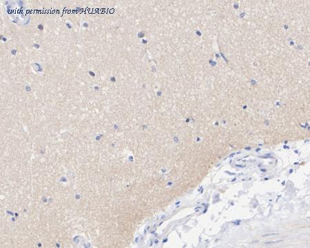 HUABIO HA722438 image 3