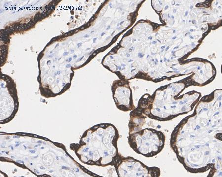 HUABIO HA722441 image 2