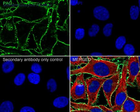 HUABIO HA722457 image 2