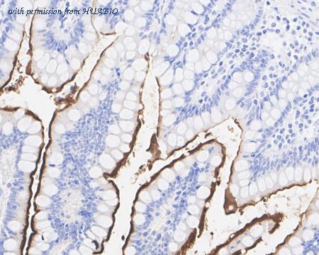 HUABIO HA722461 image 2