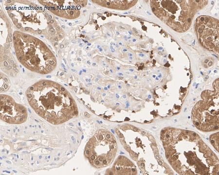 HUABIO HA722464 image 3