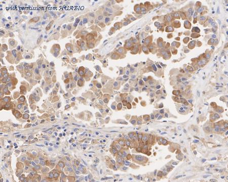 HUABIO HA722468 image 3