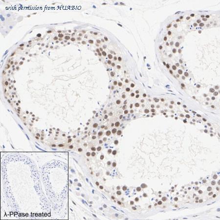 HUABIO HA722477 image 2