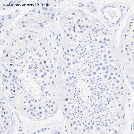 HUABIO HA722487 image 3