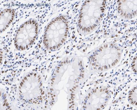 HUABIO HA722510 image 2