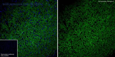 HUABIO HA722521 image 1