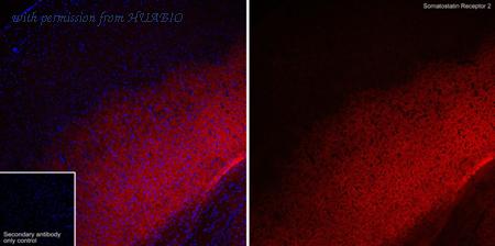 HUABIO HA722521 image 2