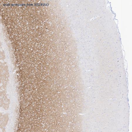 HUABIO HA722521 image 3