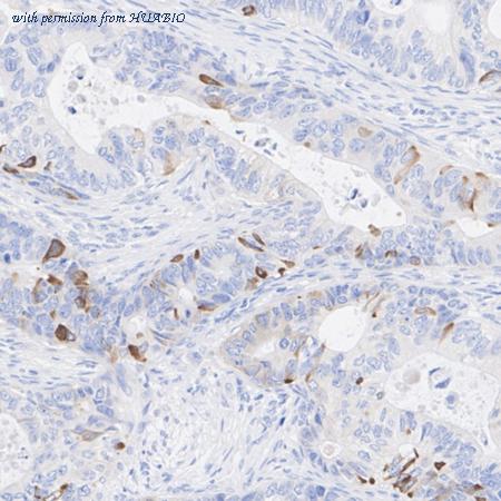 HUABIO HA722528 image 2