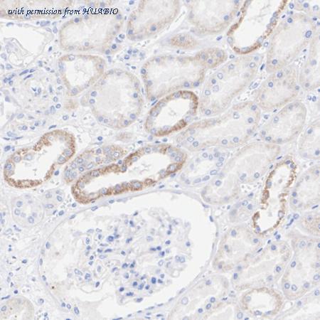 HUABIO HA722528 image 3