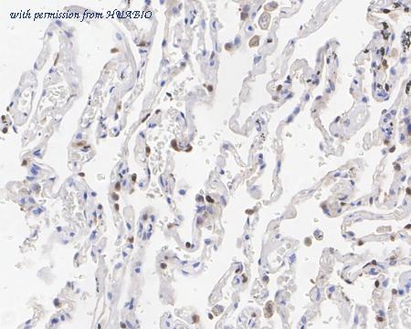 HUABIO HA722529 image 2