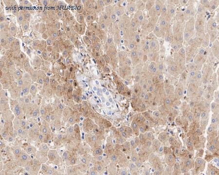 HUABIO HA722535 image 2