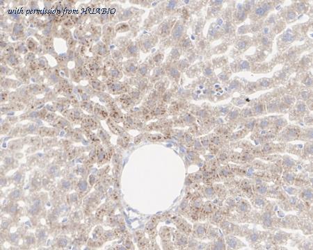 HUABIO HA722535 image 3