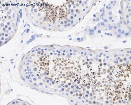 HUABIO HA722543 image 2