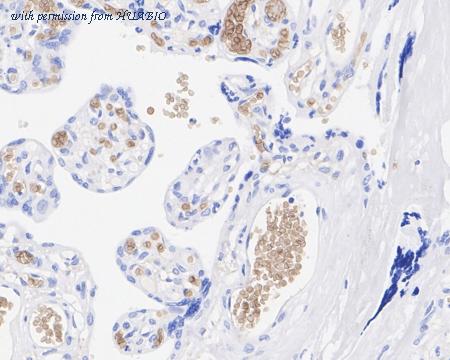 HUABIO HA722547 image 2