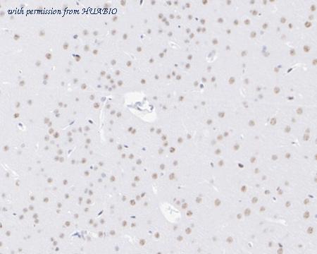 HUABIO HA722548 image 3