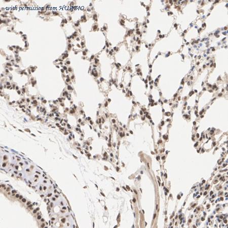 HUABIO HA722555 image 2