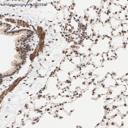 HUABIO HA722555 image 3