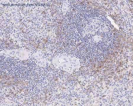 HUABIO HA722562 image 3