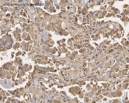 HUABIO HA722564 image 2