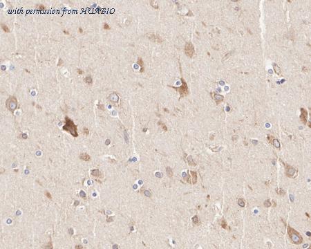 HUABIO HA722568 image 2