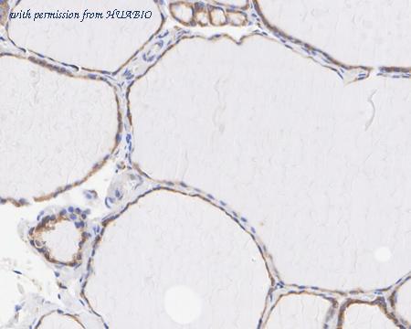 HUABIO HA722568 image 3