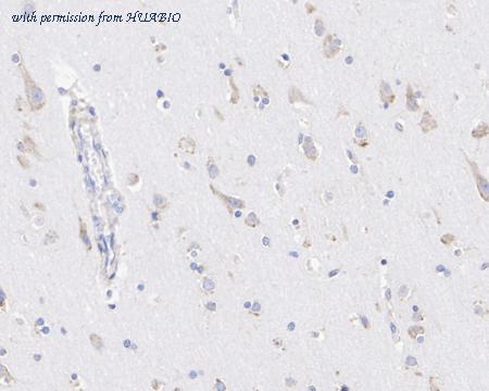 HUABIO HA722569 image 2