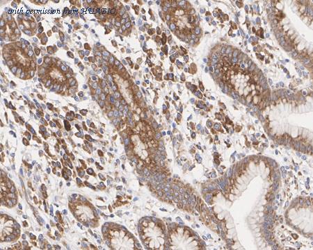 HUABIO HA722569 image 3